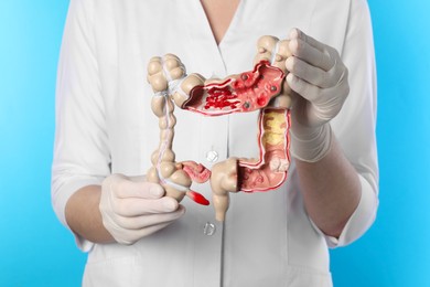 Photo of Doctor with model of large intestine on light blue background, closeup