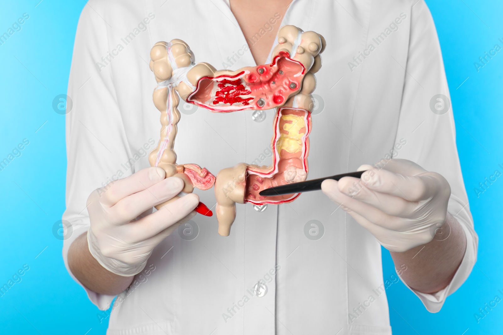 Photo of Doctor showing model of large intestine on light blue background, closeup