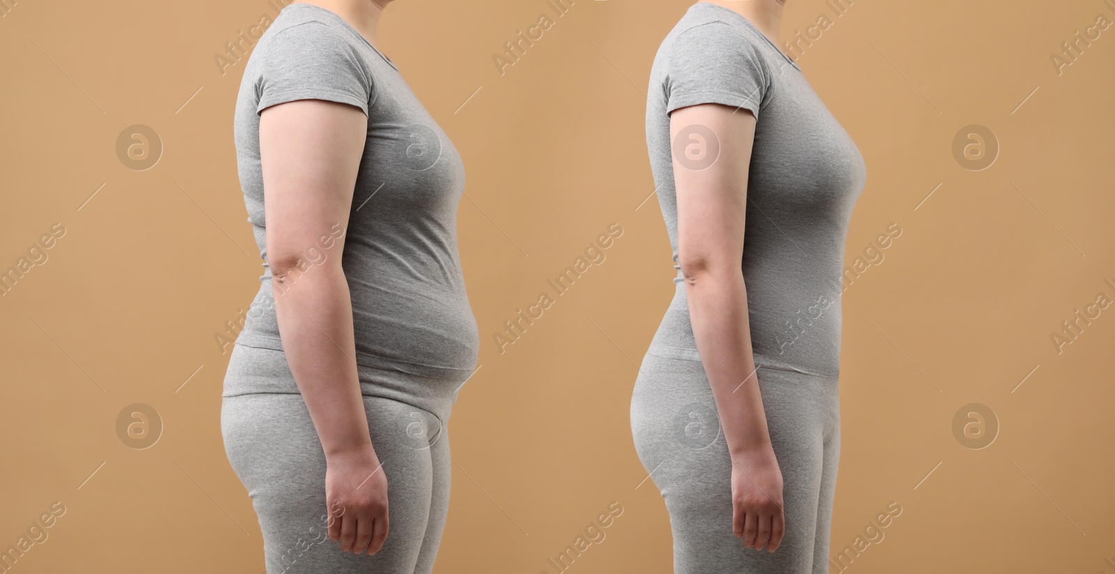 Image of Collage with photos of woman before and after weight loss on beige background, closeup