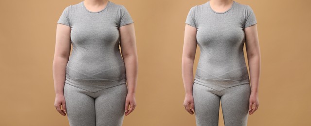 Image of Collage with photos of woman before and after weight loss on beige background, closeup