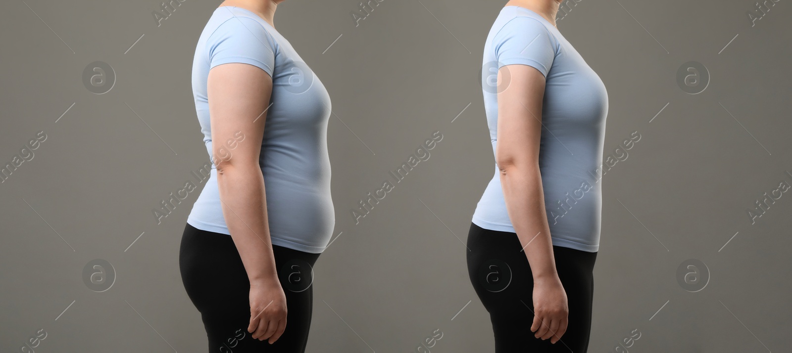 Image of Collage with photos of woman before and after weight loss on grey background, closeup