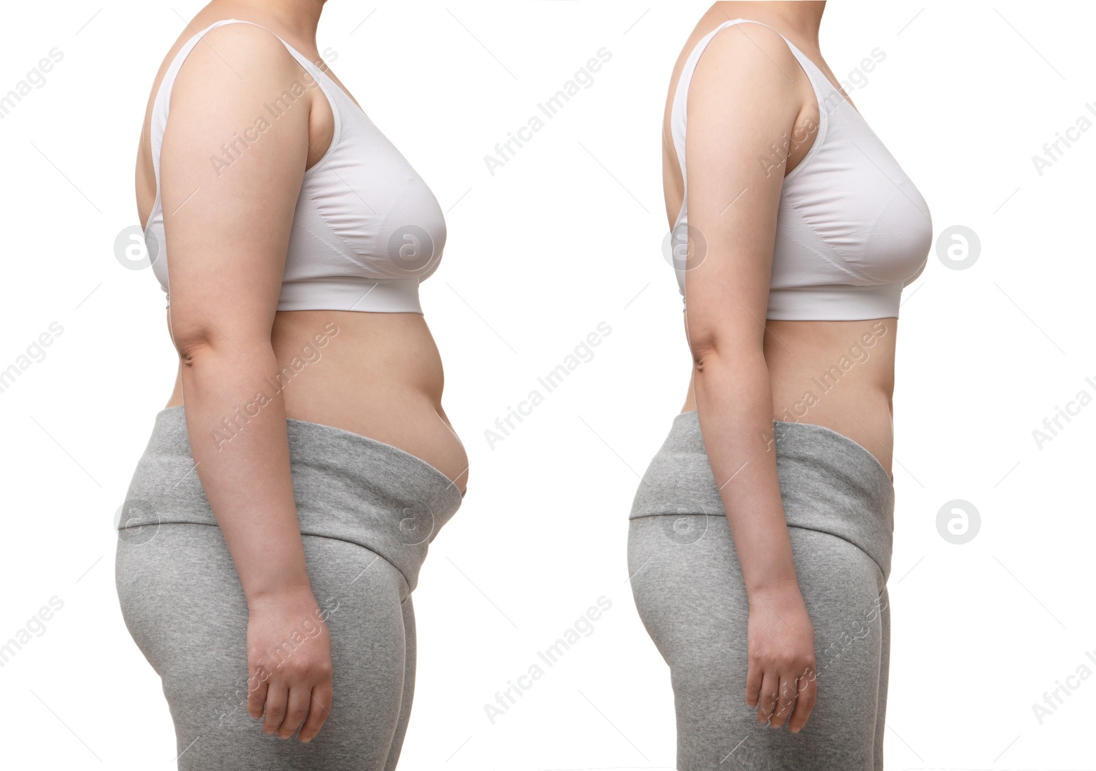 Image of Collage with photos of woman before and after weight loss on white background, closeup