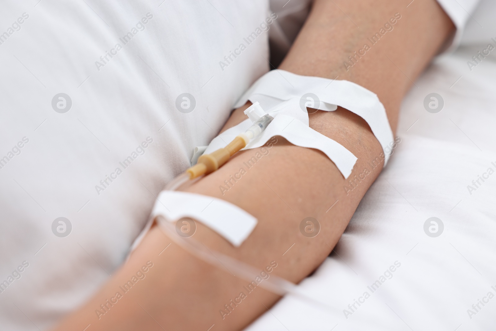 Photo of Woman with intravenous drip in hospital bed, closeup