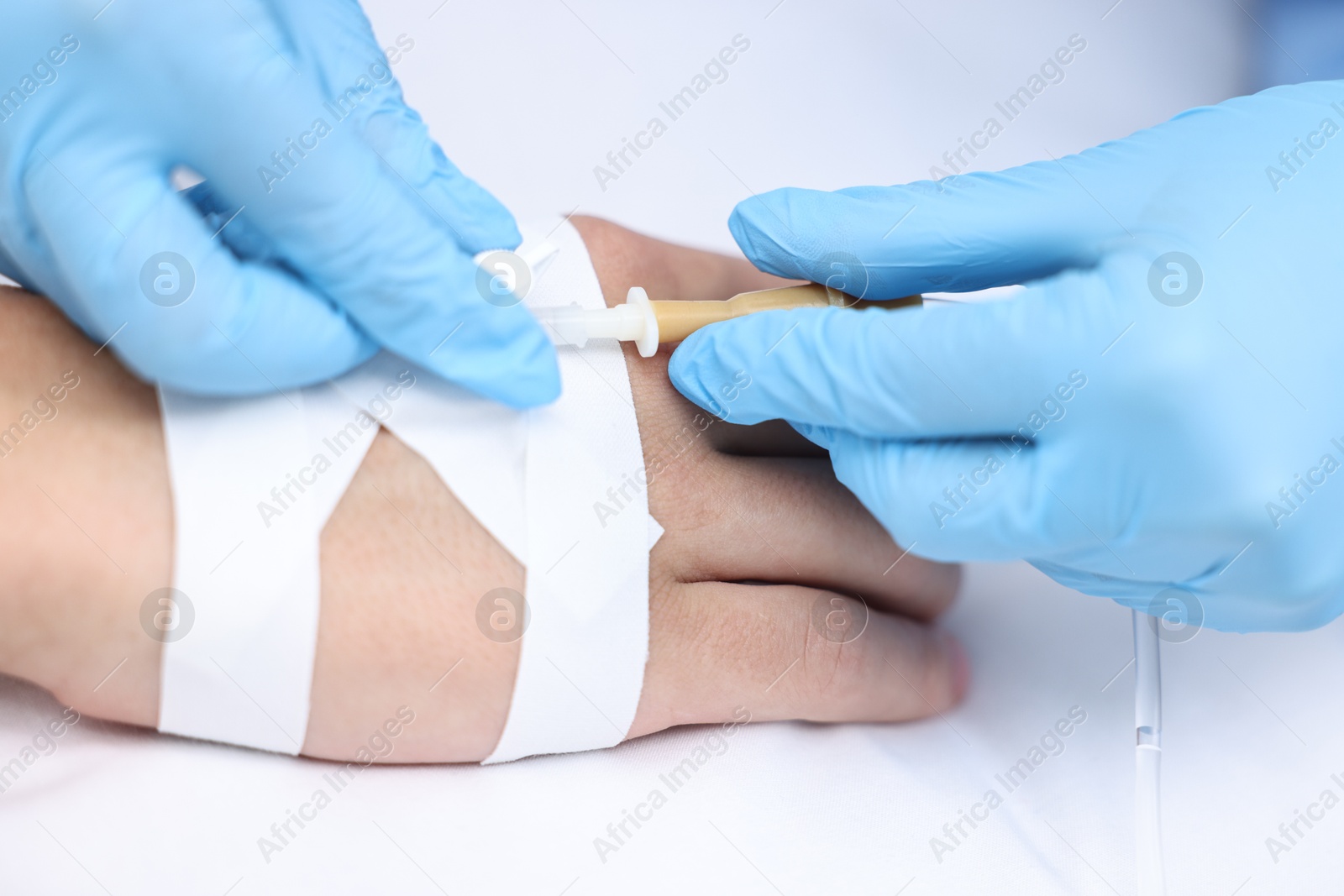 Photo of Nurse inserting IV into arm of patient in hospital, closeup