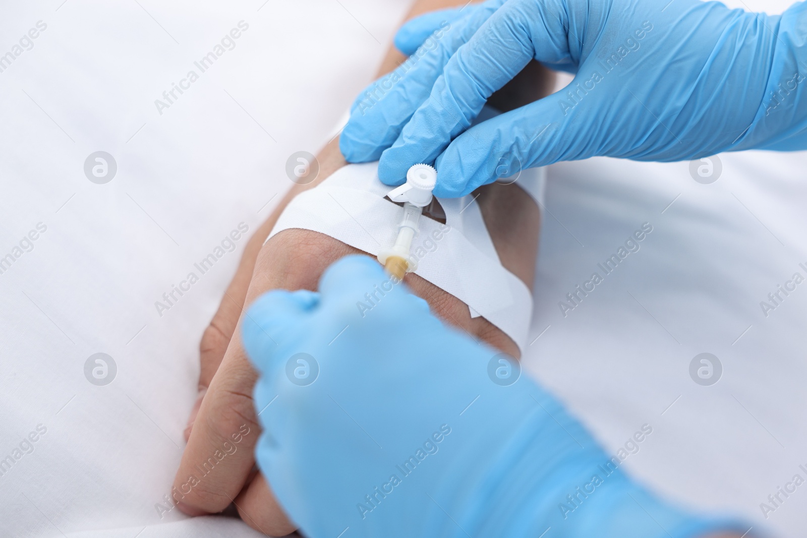 Photo of Nurse inserting IV into arm of patient in hospital, closeup