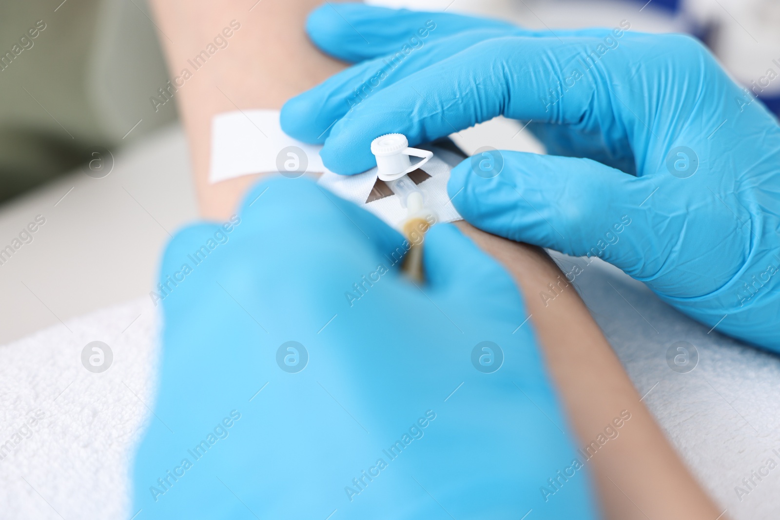 Photo of Nurse inserting IV into arm of patient in hospital, closeup