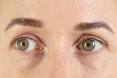 Photo of Woman with beautiful green eyes, closeup view