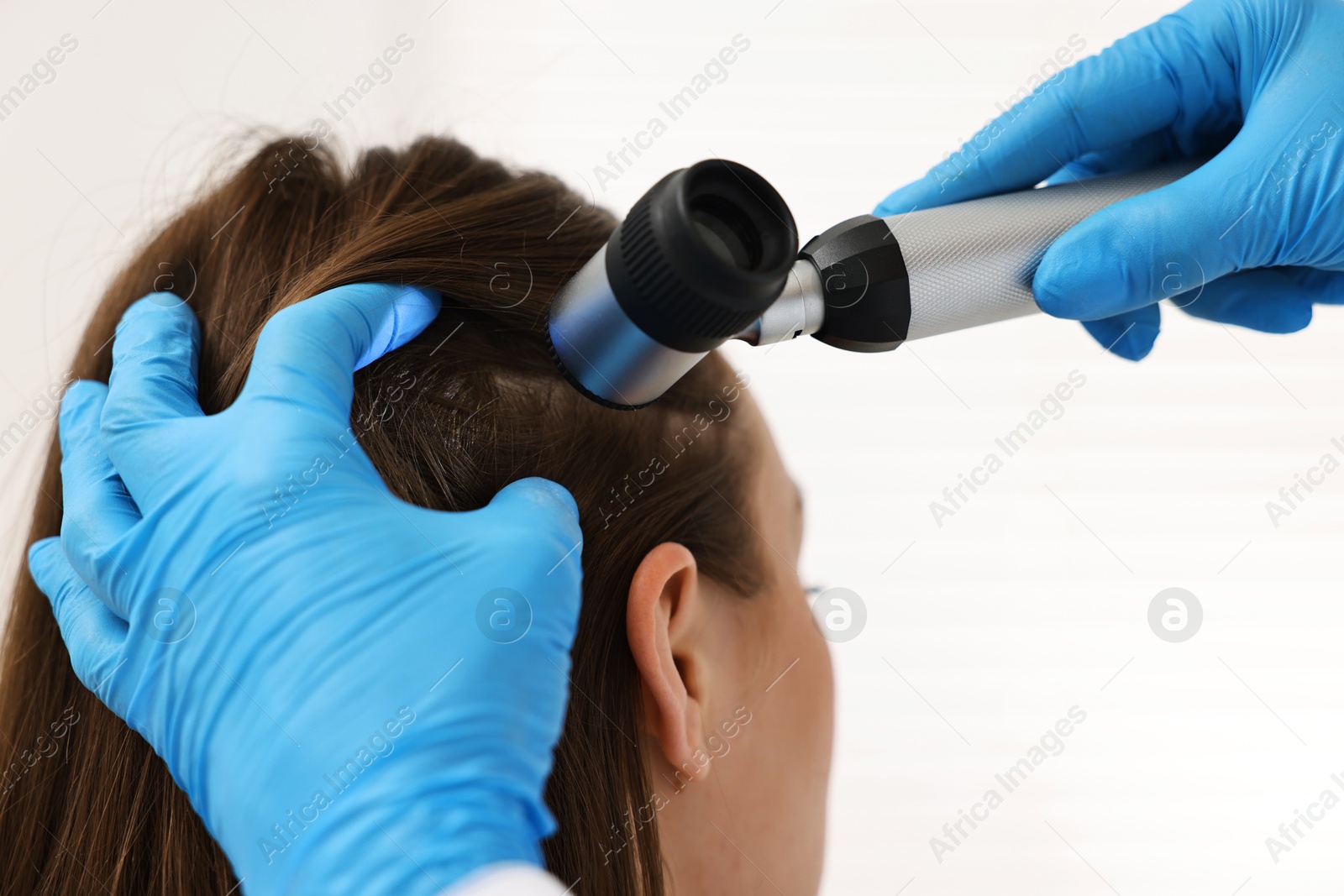 Photo of Trichologist with dermatoscope examining patient`s hair in clinic, closeup