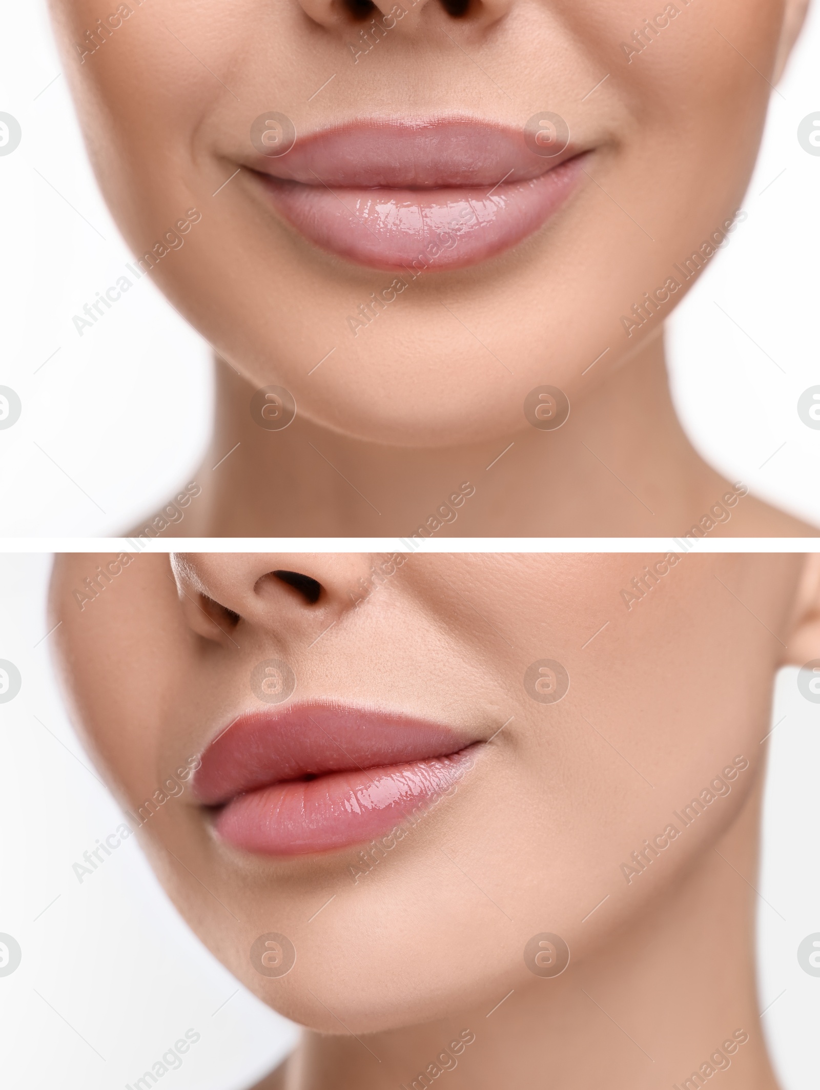 Image of Permanent makeup. Collage with photos of woman before and after lip blushing on white background, closeup