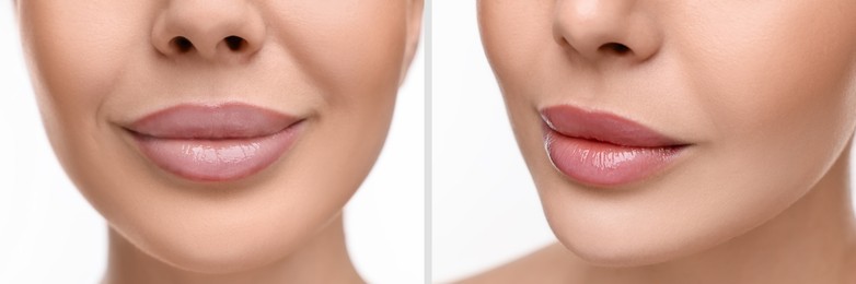 Permanent makeup. Collage with photos of woman before and after lip blushing on white background, closeup