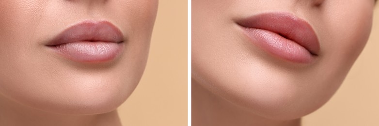 Permanent makeup. Collage with photos of woman before and after lip blushing on beige background, closeup