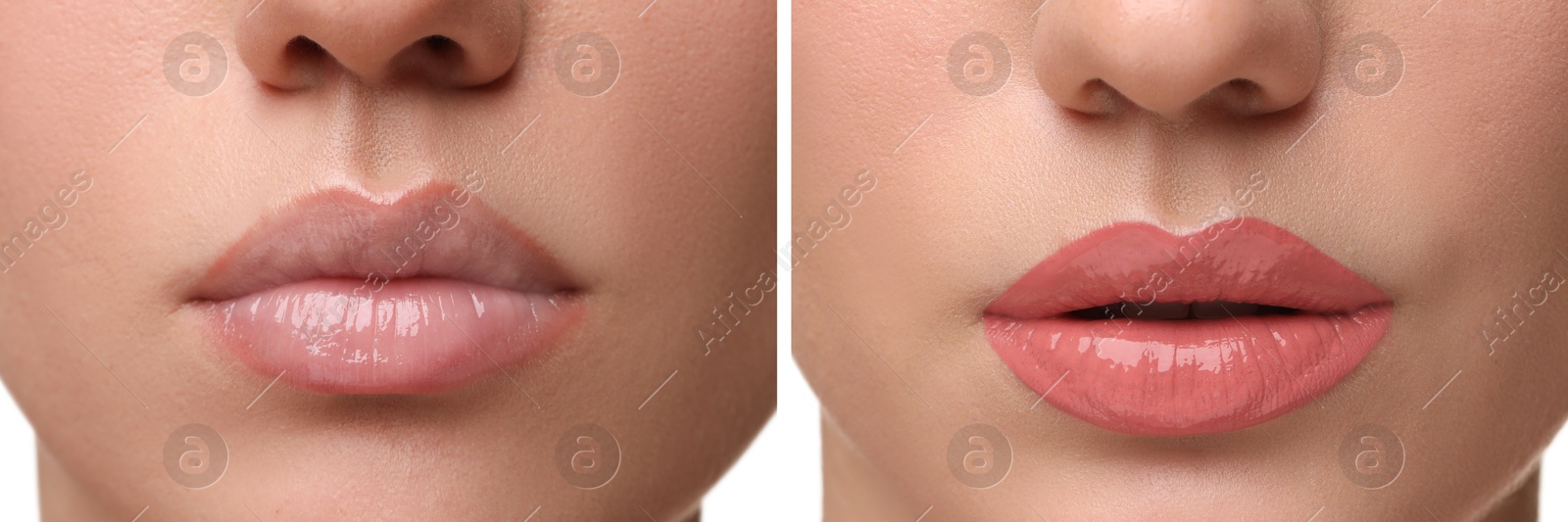 Image of Permanent makeup. Collage with photos of woman before and after lip blushing, closeup