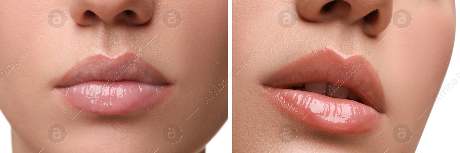 Image of Permanent makeup. Collage with photos of woman before and after lip blushing on white background, closeup