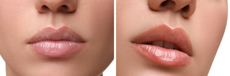 Permanent makeup. Collage with photos of woman before and after lip blushing on white background, closeup