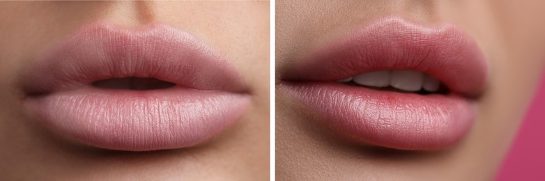 Image of Permanent makeup. Collage with photos of woman before and after lip blushing, closeup