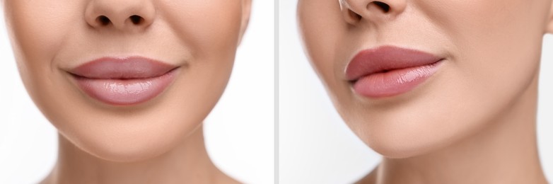 Image of Permanent makeup. Collage with photos of woman before and after lip blushing on white background, closeup