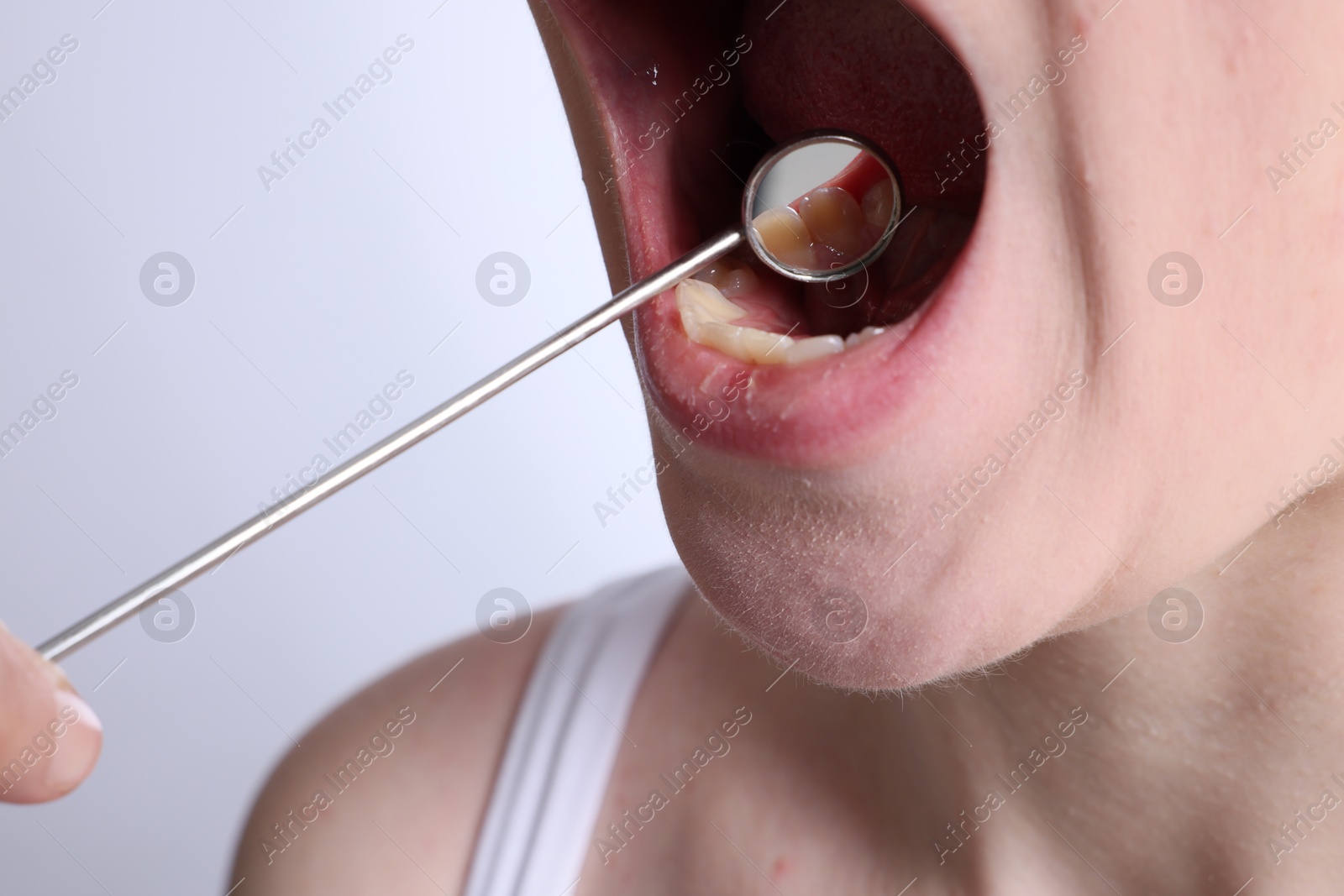 Photo of Examining young woman's teeth and gums with mirror on white background, closeup