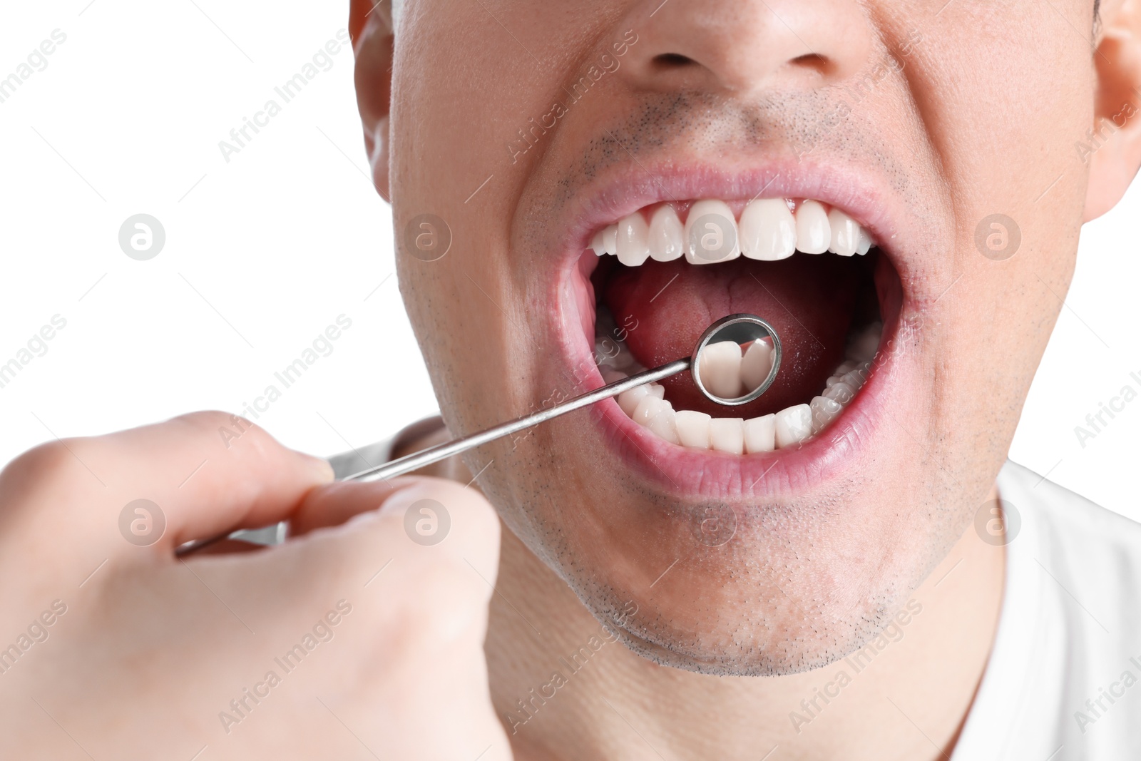 Photo of Dentist examining man's teeth and gums with mirror on white background, closeup