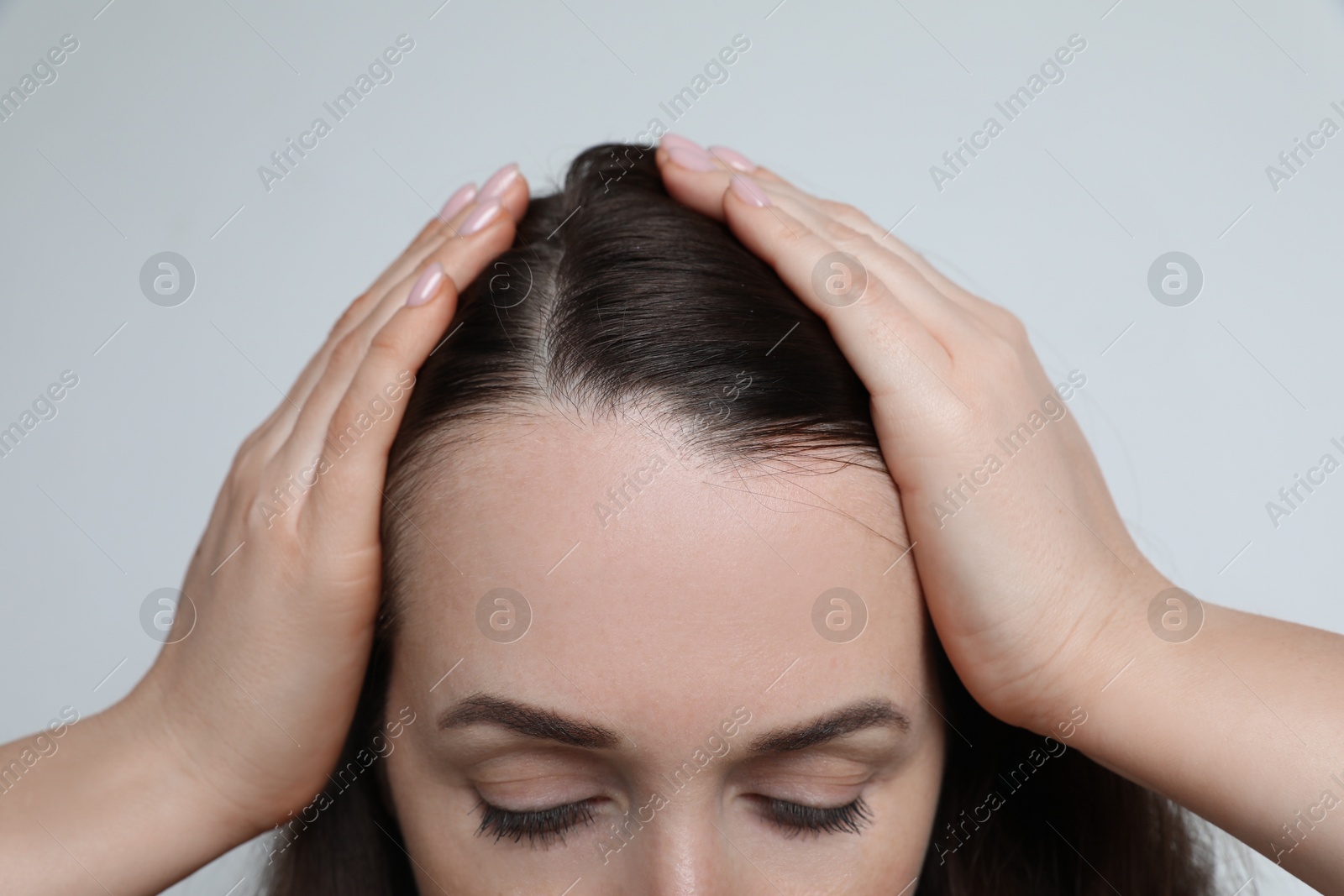 Photo of Woman with hair loss problem on light background, closeup