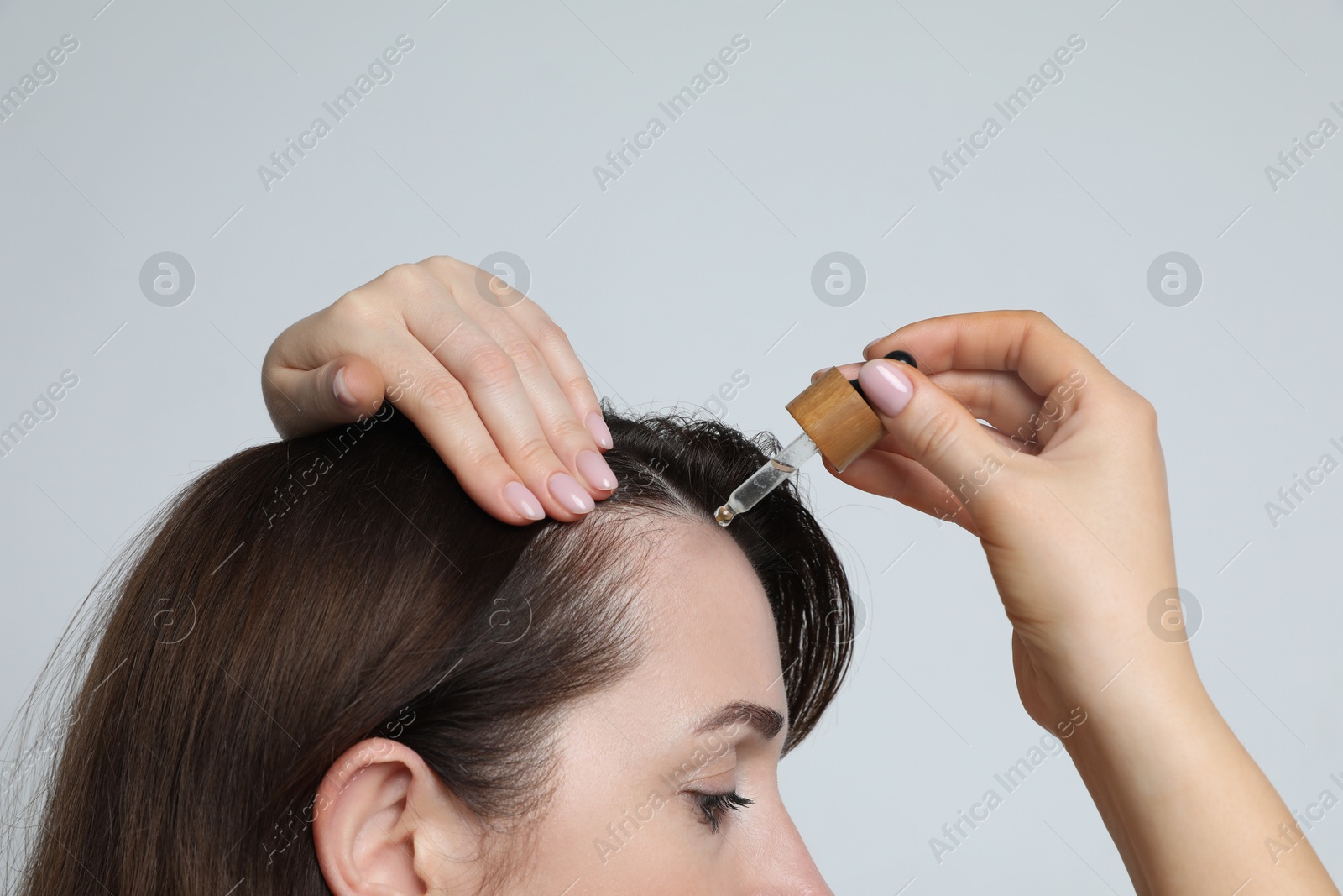 Photo of Hair loss problem. Woman applying serum onto hairline on light background, closeup