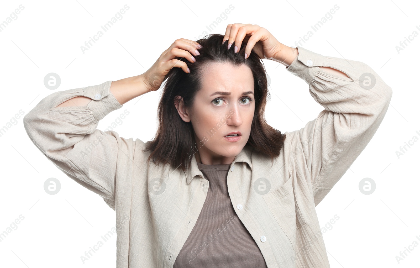 Photo of Woman with hair loss problem on white background