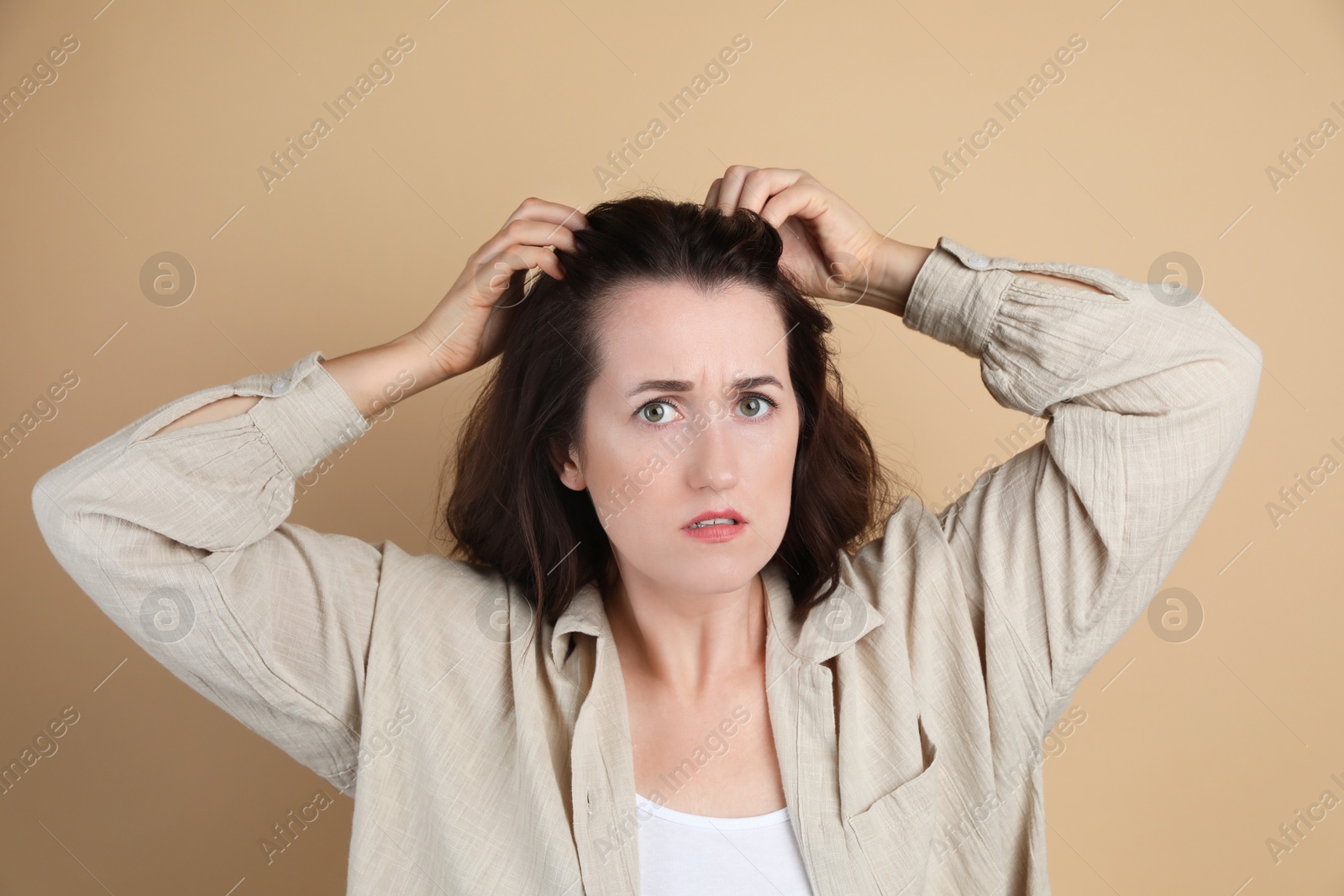 Photo of Woman with hair loss problem on beige background