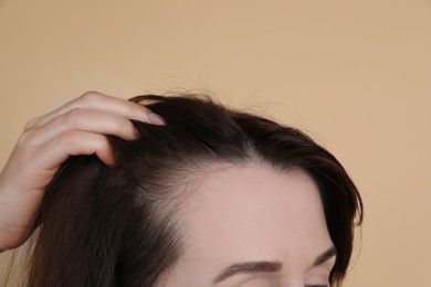 Photo of Woman with hair loss problem on beige background, closeup