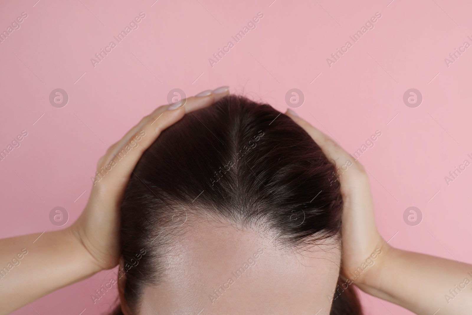 Photo of Woman with hair loss problem on pink background, closeup