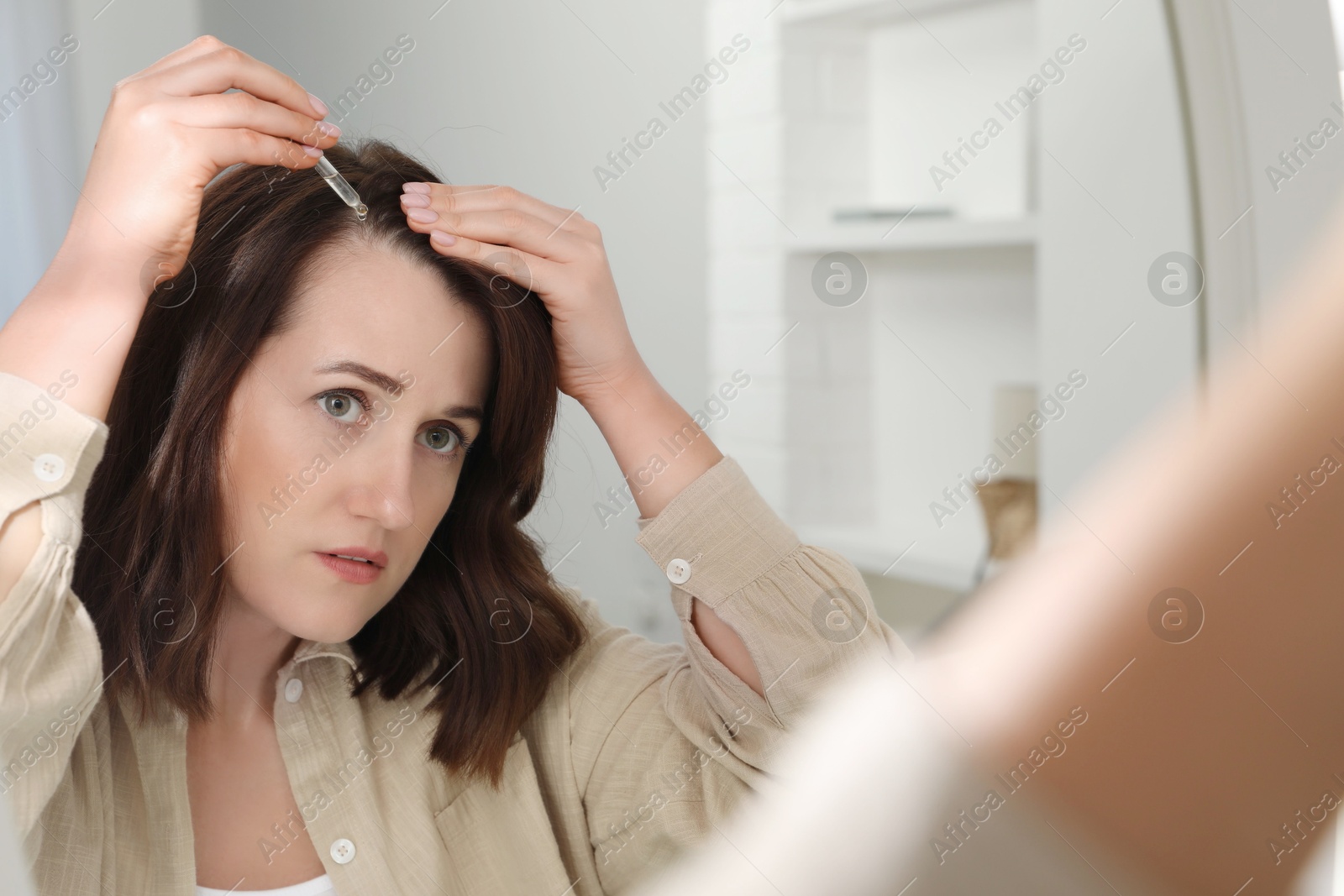 Photo of Hair loss problem. Woman applying serum onto hairline near mirror at home