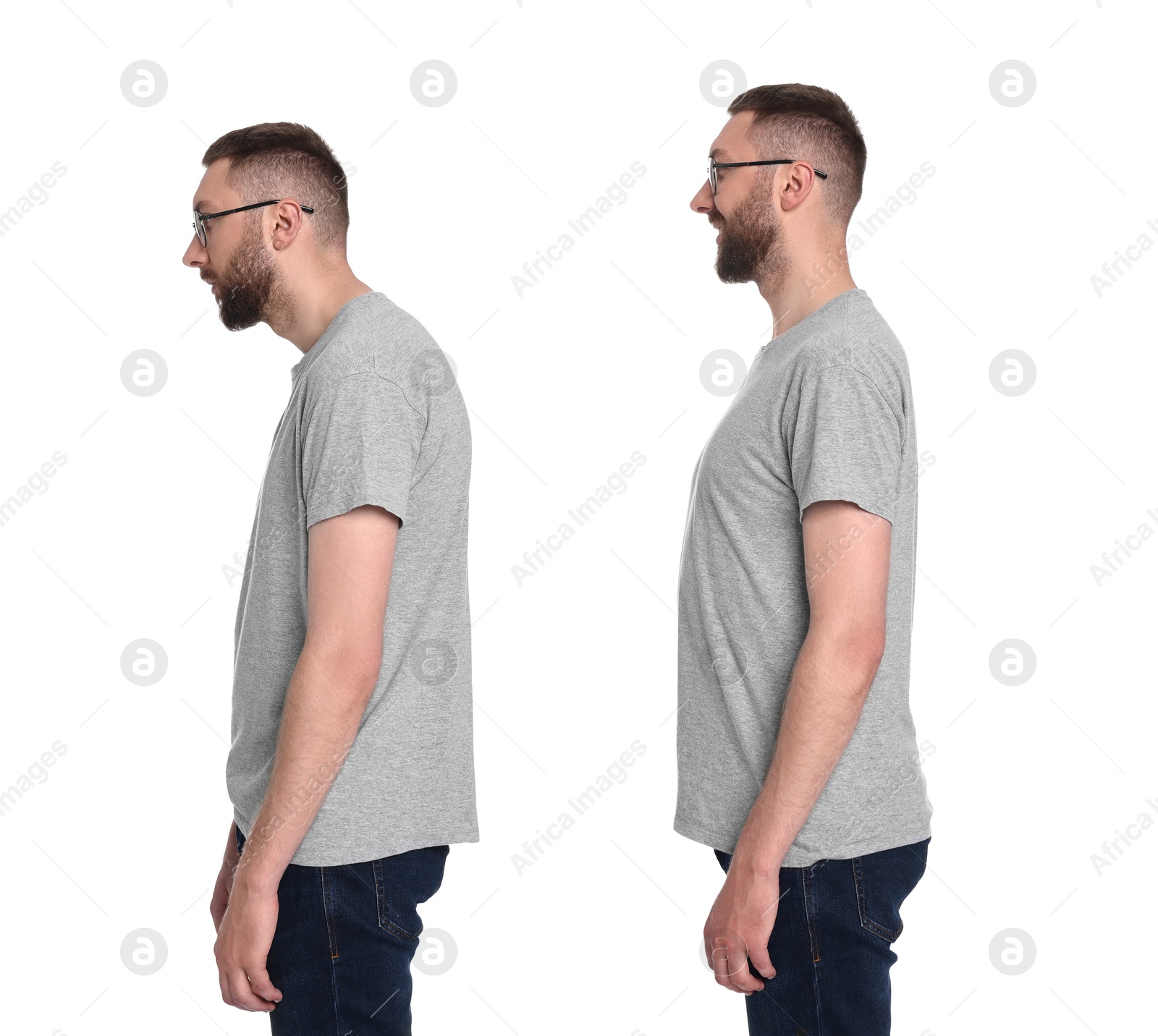 Image of Man with poor and good posture on white background, collage of photos