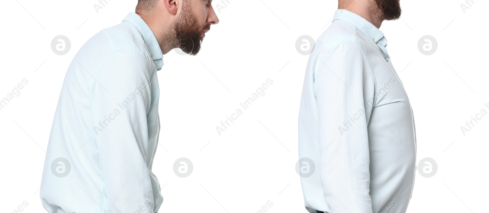 Image of Man with poor and good posture on white background, closeup. Collage of photos
