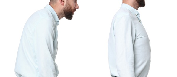 Man with poor and good posture on white background, closeup. Collage of photos