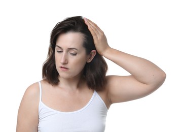 Woman with hair loss problem on white background