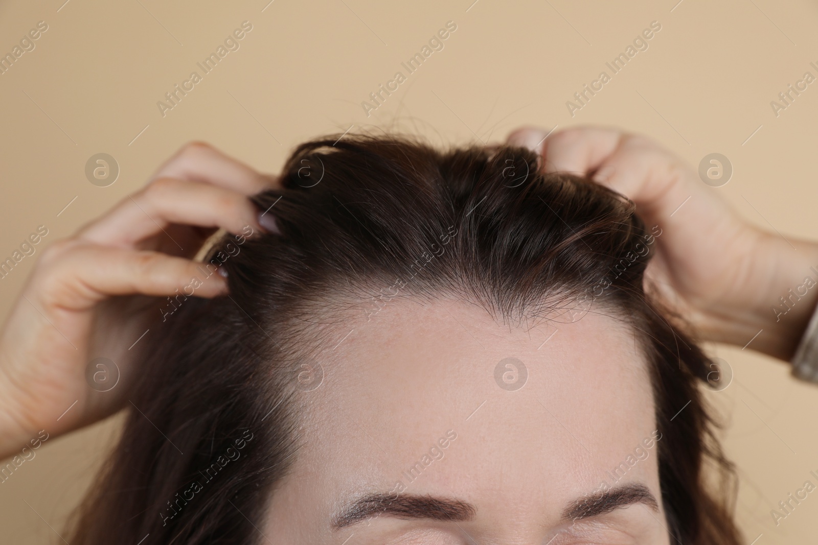 Photo of Woman with hair loss problem on beige background, closeup