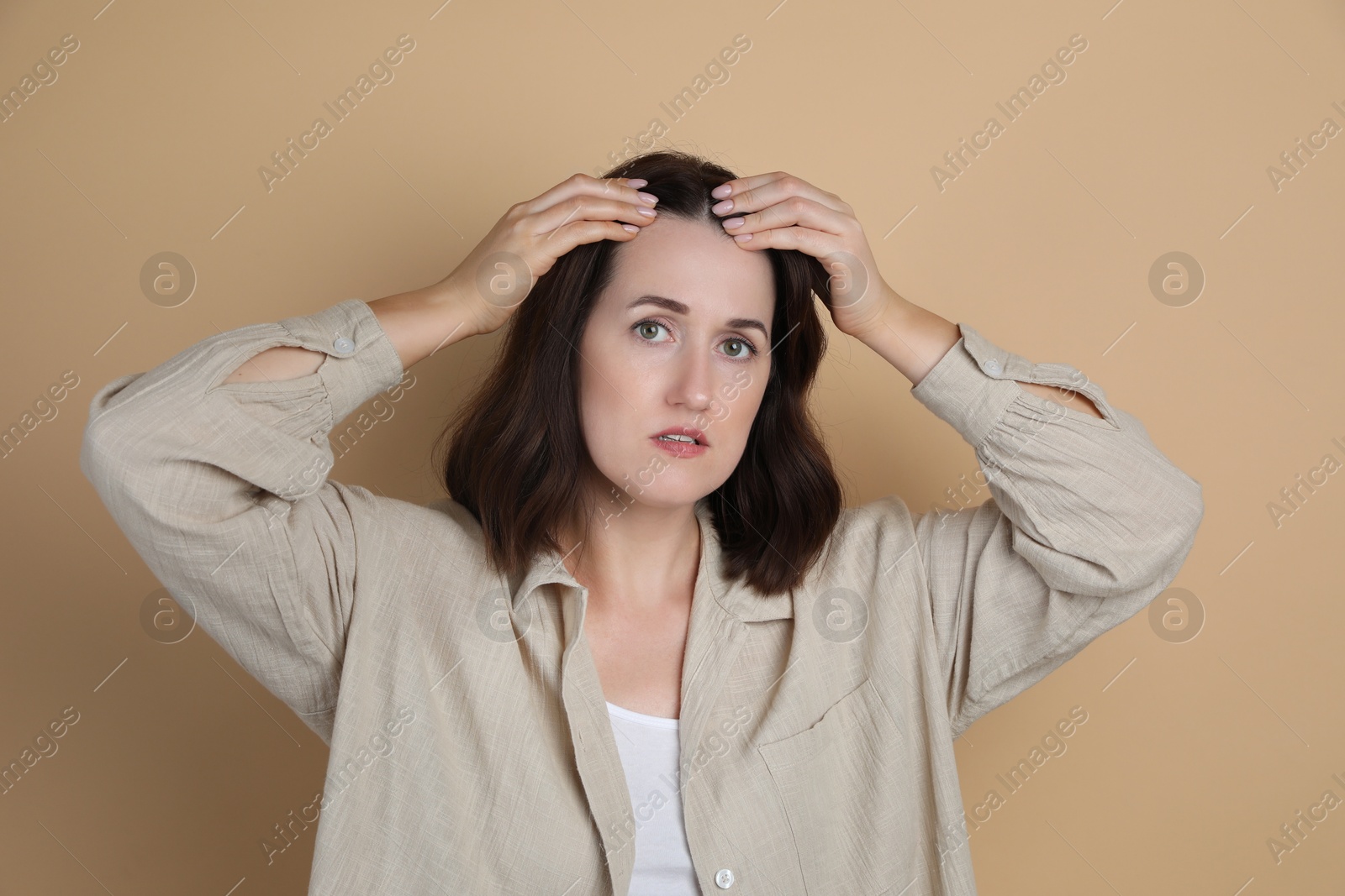 Photo of Woman with hair loss problem on beige background