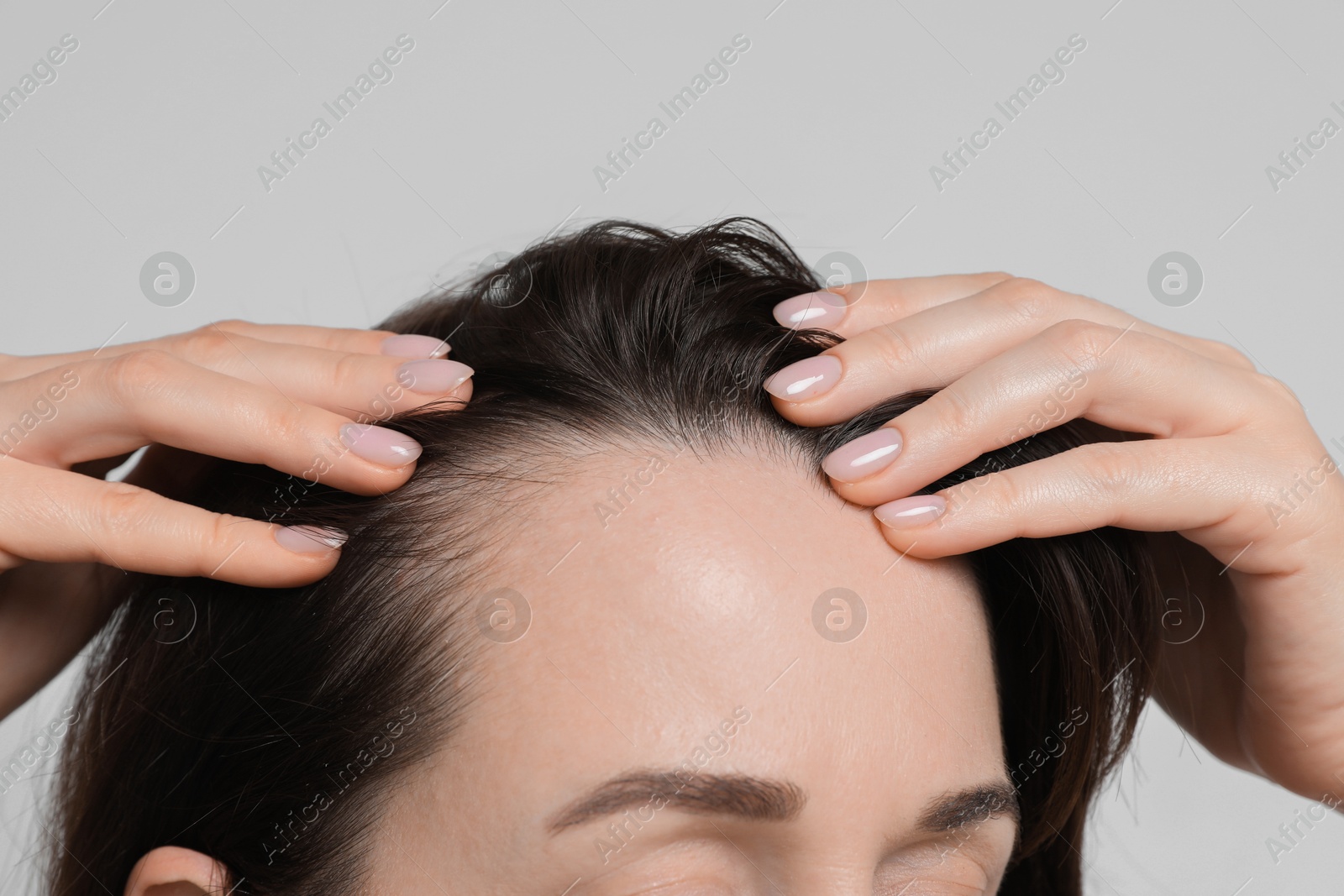 Photo of Woman with hair loss problem on light background, closeup