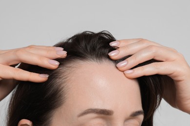 Photo of Woman with hair loss problem on light background, closeup