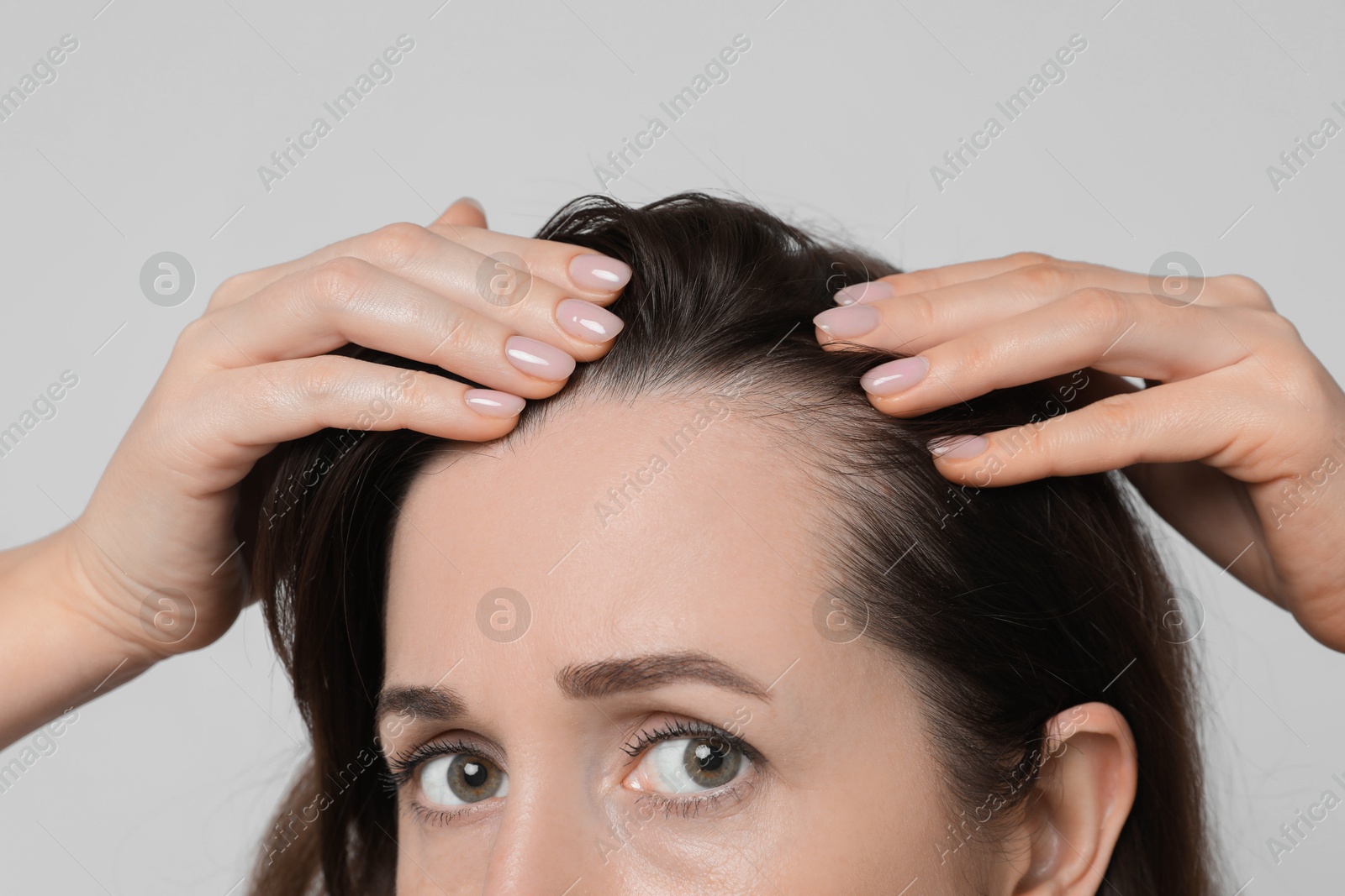 Photo of Woman with hair loss problem on light background, closeup