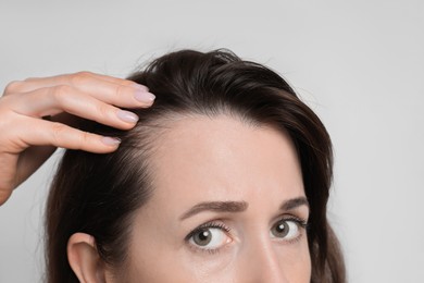 Photo of Woman with hair loss problem on light background, closeup