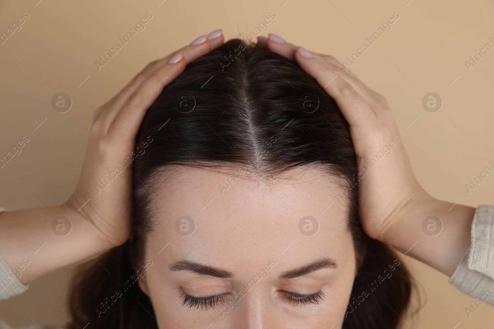 Photo of Woman with hair loss problem on beige background, closeup