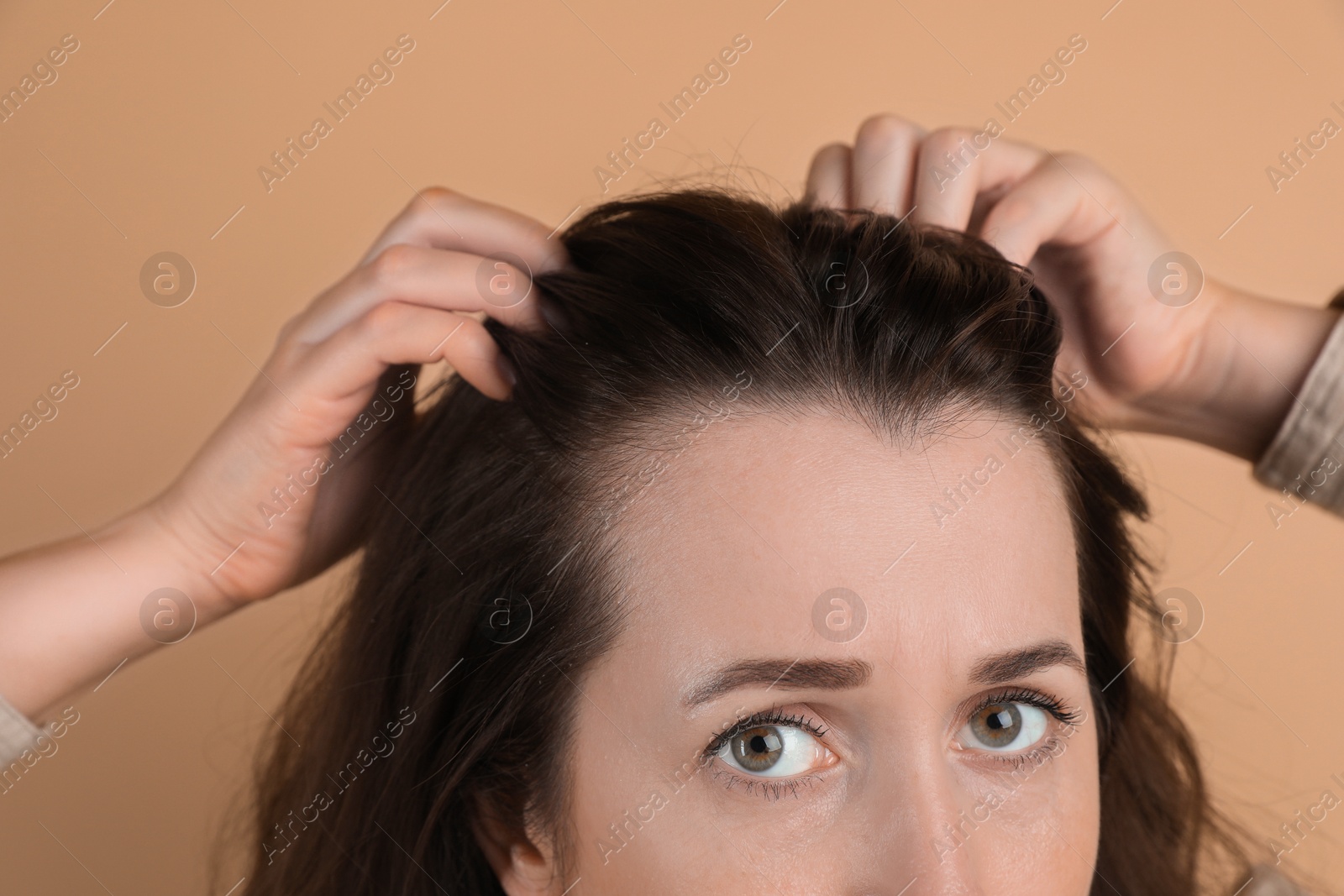 Photo of Woman with hair loss problem on beige background, closeup