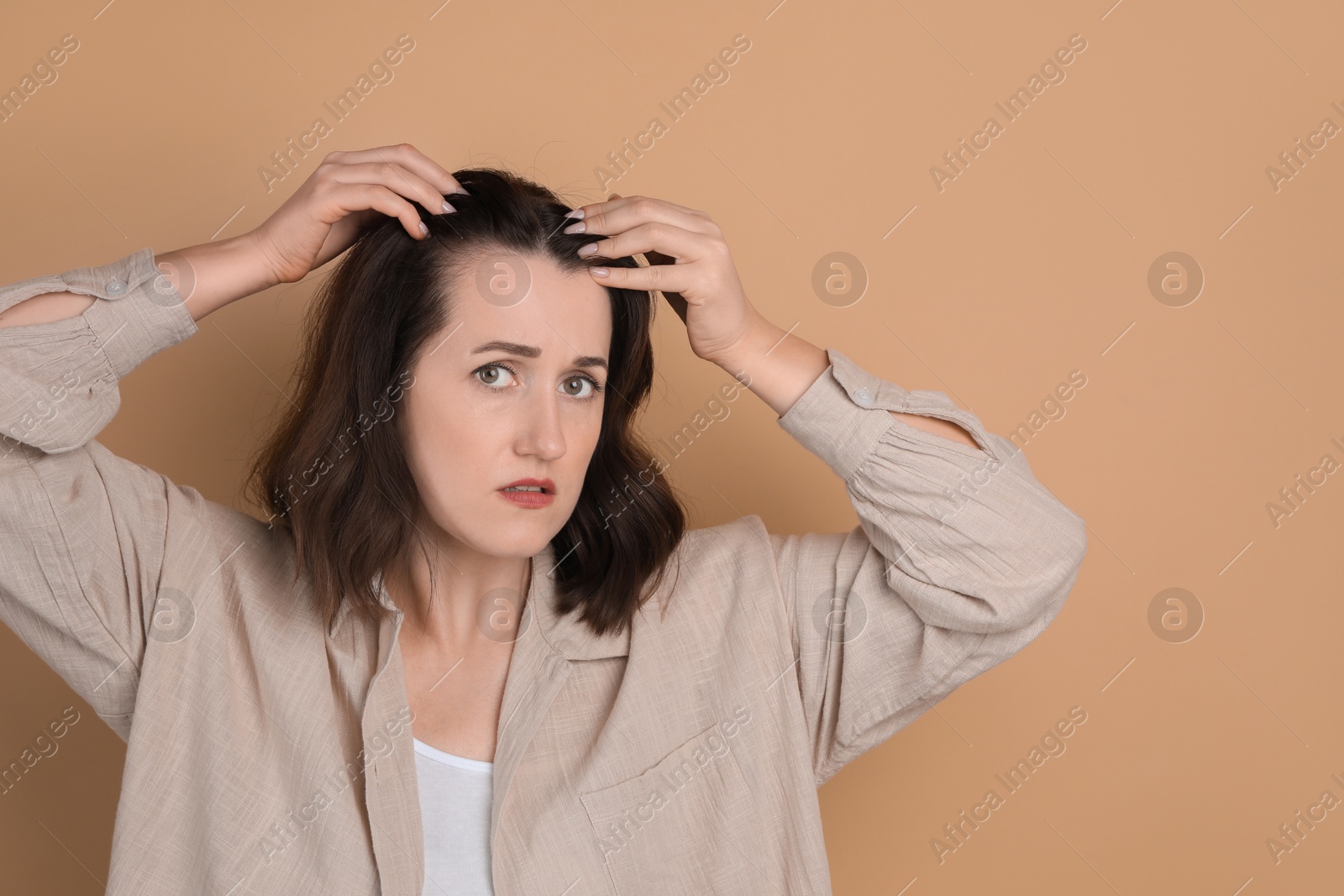 Photo of Woman with hair loss problem on beige background