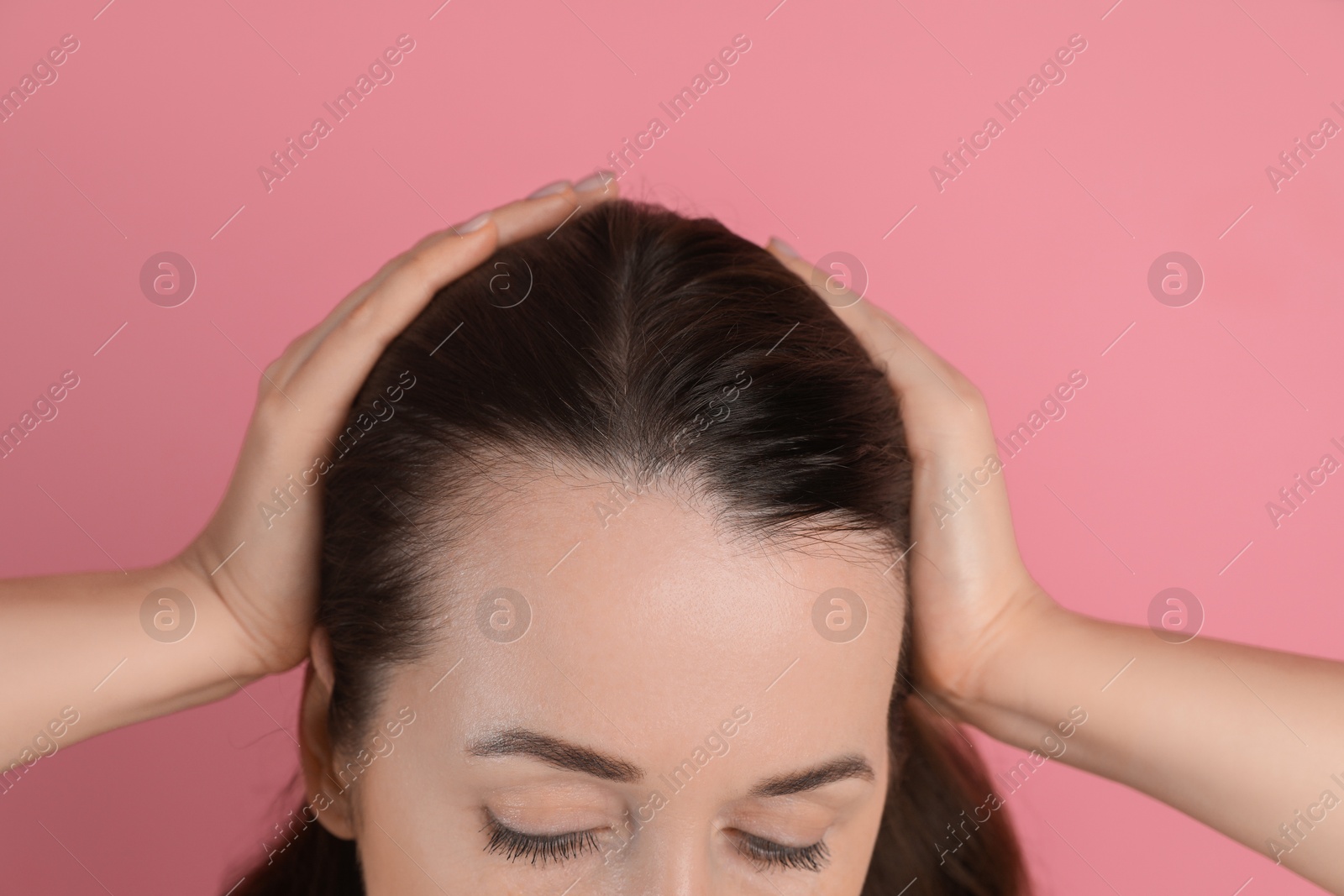 Photo of Woman with hair loss problem on pink background, closeup