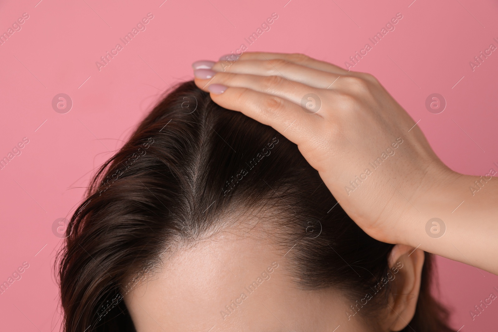 Photo of Woman with hair loss problem on pink background, closeup