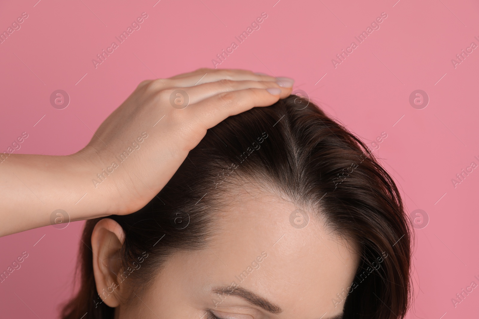 Photo of Woman with hair loss problem on pink background, closeup