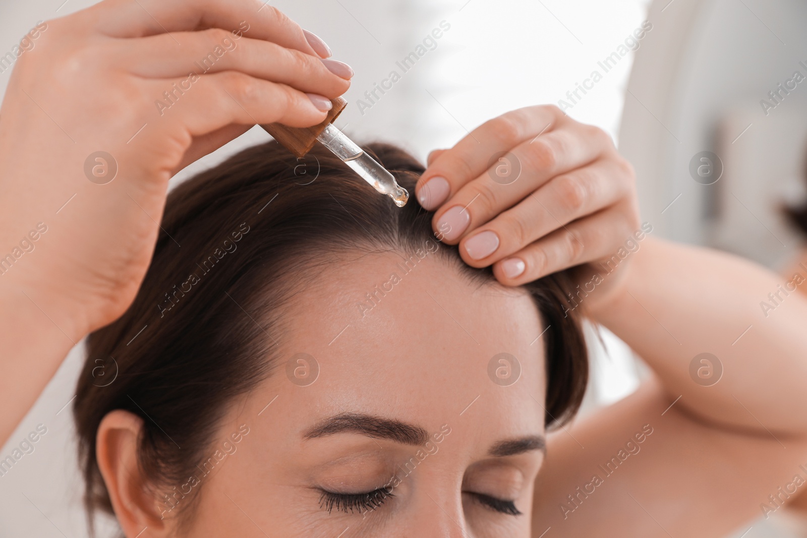 Photo of Hair loss problem. Woman applying serum onto hairline indoors, closeup