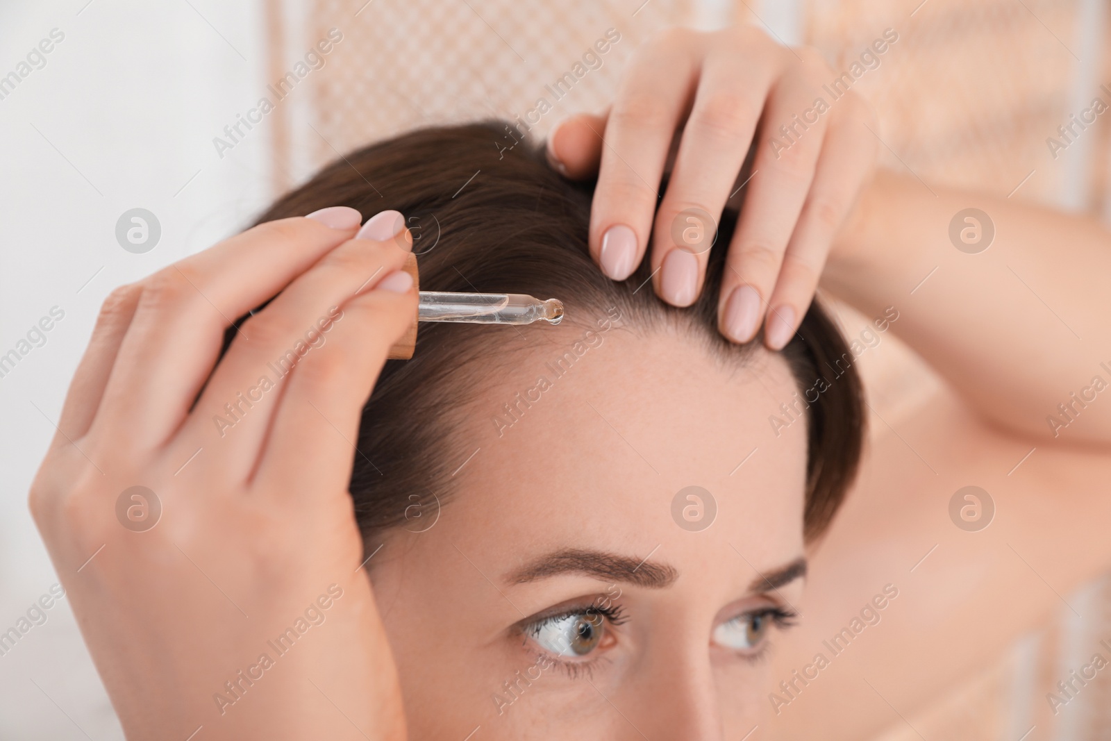 Photo of Hair loss problem. Woman applying serum onto hairline indoors, closeup