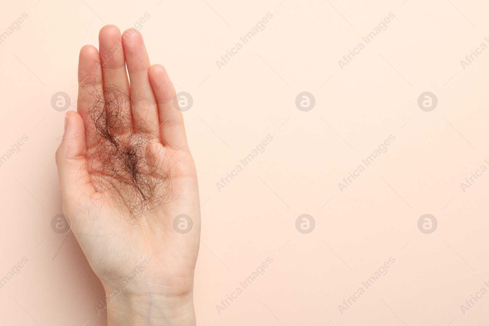 Photo of Woman with lost hair on light pink background, top view. Space for text