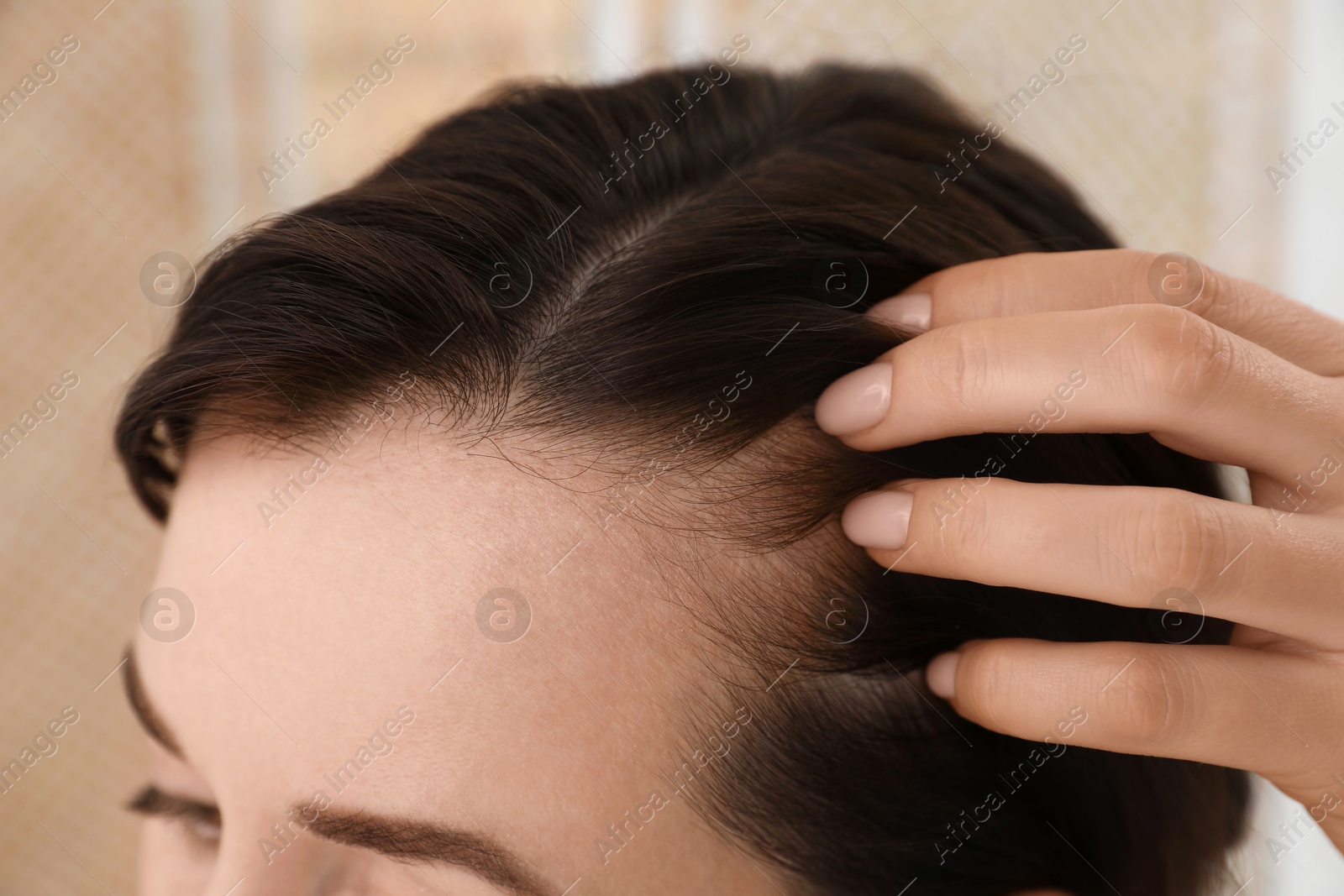 Photo of Woman with hair loss problem at home, closeup