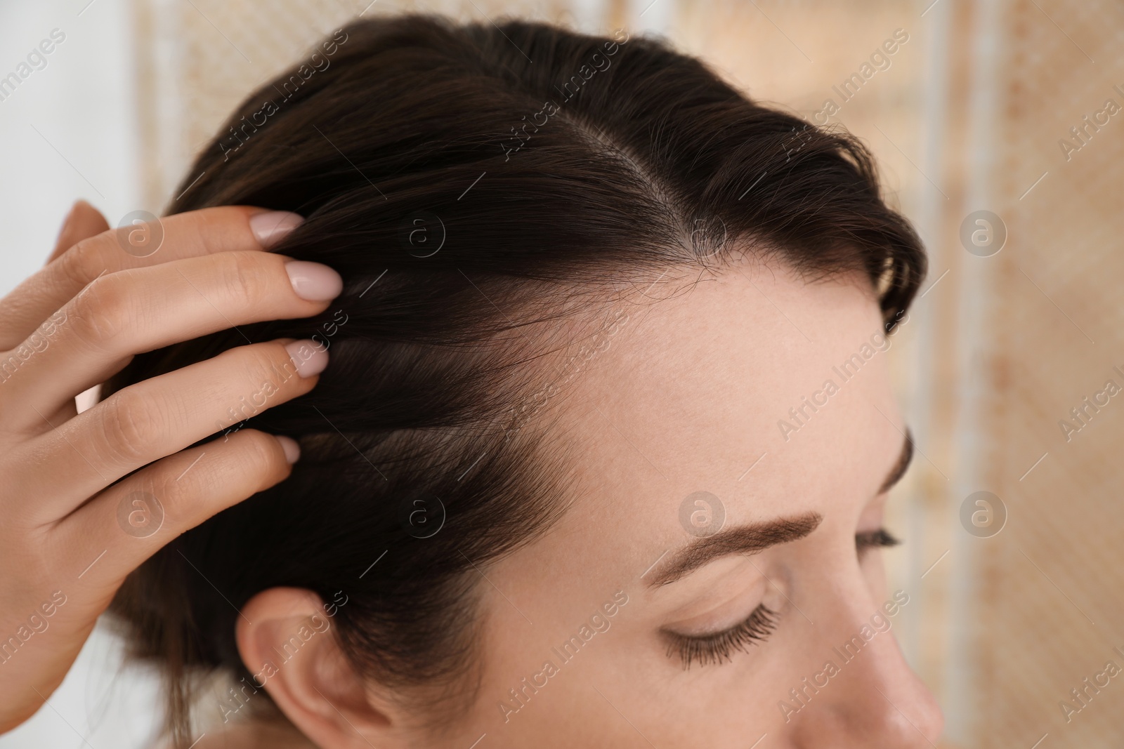 Photo of Woman with hair loss problem at home, closeup